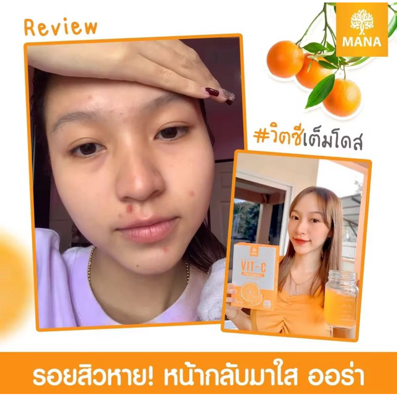 Vitamin C tăng cường miễn dịch-duoc-ban-tai-Alice Boutique