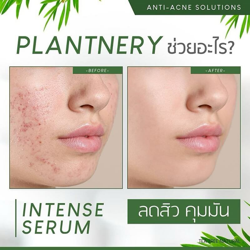 Plantnery Pomegranate First Toner, Tea Tree Toner Acne Reduction, Yuzu Orange VitC 250ml-duoc-ban-tai-Alice Boutique