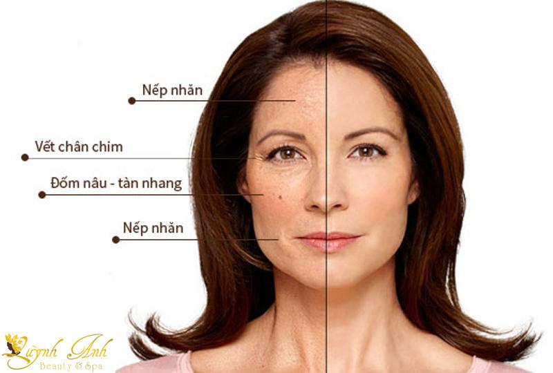 Nâng cơ mặt xavia-duoc-ban-tai-TRANG QUỲNH BEAUTY & SPA