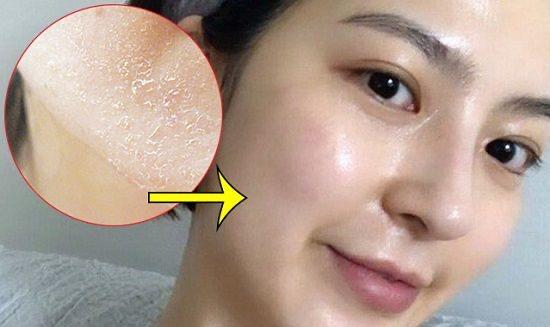 peel da-duoc-ban-tai-TRANG QUỲNH BEAUTY & SPA