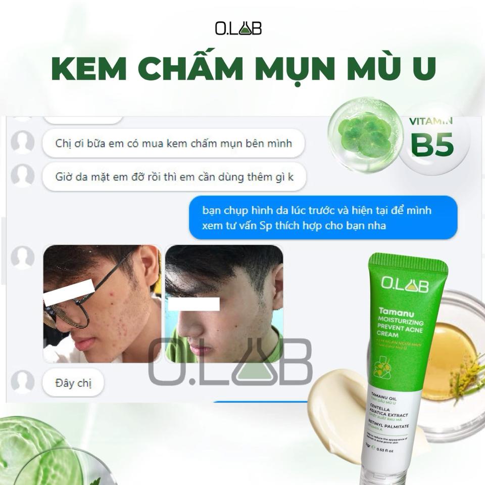 Kem Chấm Mụn Mù U -duoc-ban-tai-Uyên Lam Cosmetics