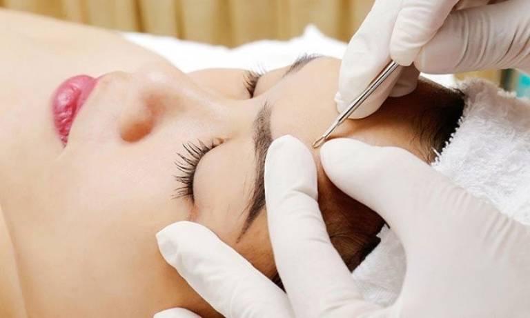 Lấy nhân mụn chuyên sâu VIP-duoc-ban-tai-Ngọc Thảo Beauty & Spa