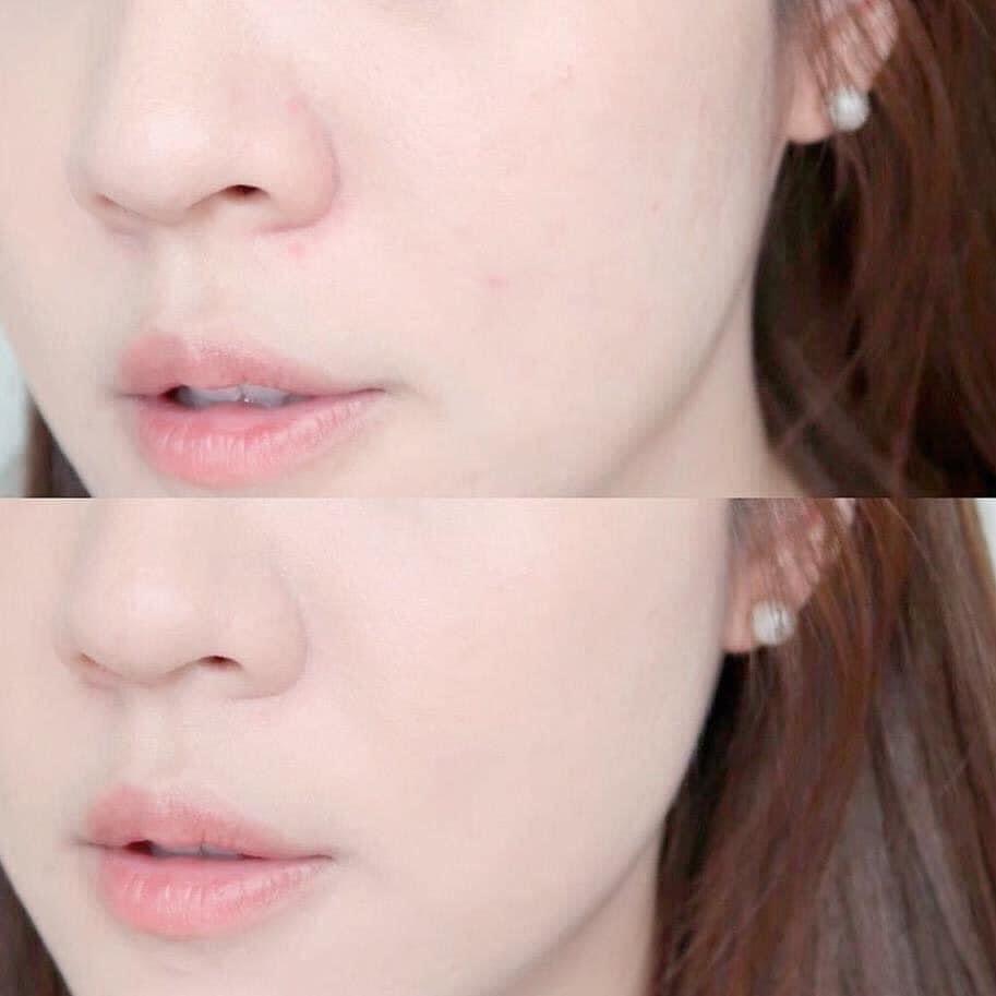 Serum the Ordinary AHA 30% + BHA 2% Peeling Solution-duoc-ban-tai-𝑮𝒂̣𝒐 𝑪𝒐𝒔𝒎𝒆𝒔𝒕𝒊𝒄𝒔