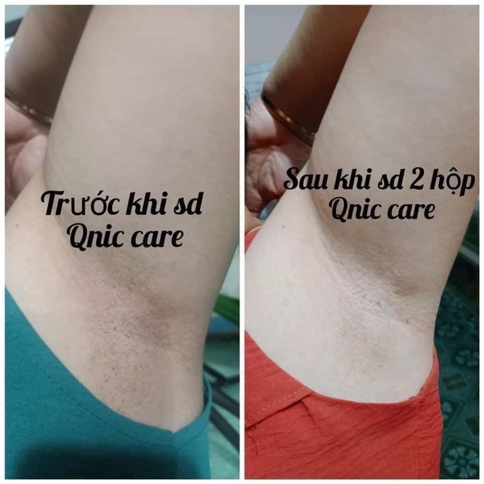 Kem Trị Thâm Nách Qnic Care Thailan Mẫu Mới-duoc-ban-tai-𝑮𝒂̣𝒐 𝑪𝒐𝒔𝒎𝒆𝒔𝒕𝒊𝒄𝒔