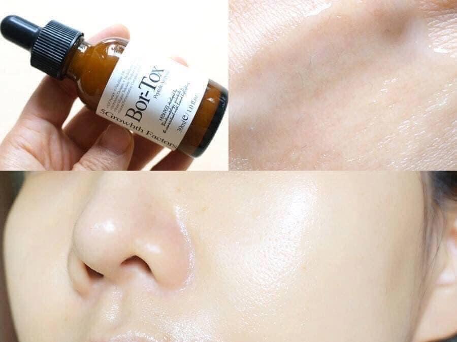 Serum Medipeel Bortox Peptide-duoc-ban-tai-𝑮𝒂̣𝒐 𝑪𝒐𝒔𝒎𝒆𝒔𝒕𝒊𝒄𝒔