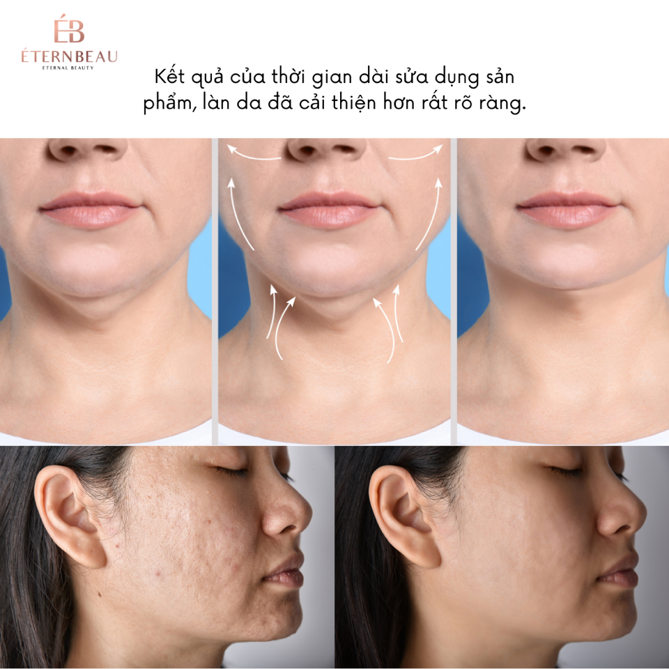 Kem dưỡng ẩm ban đêm Sakura-duoc-ban-tai-EBstore
