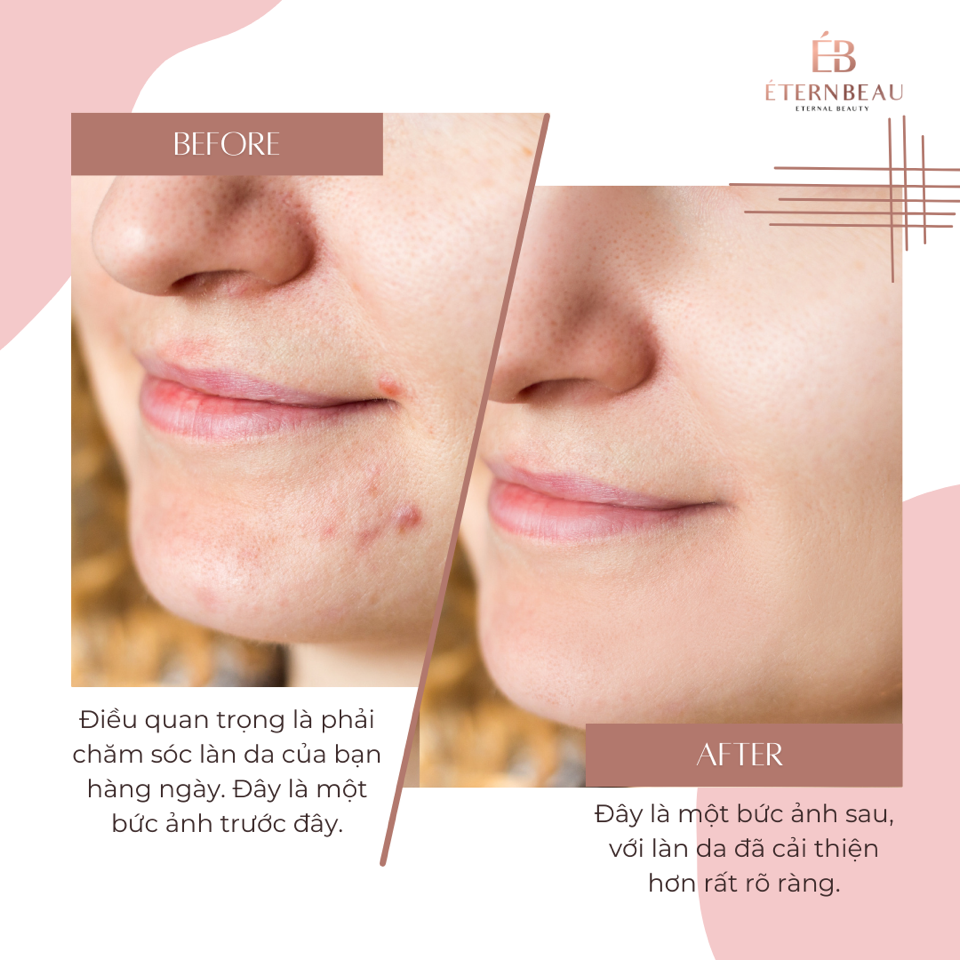 Sữa rửa mặt tạo bọt -duoc-ban-tai-EBstore