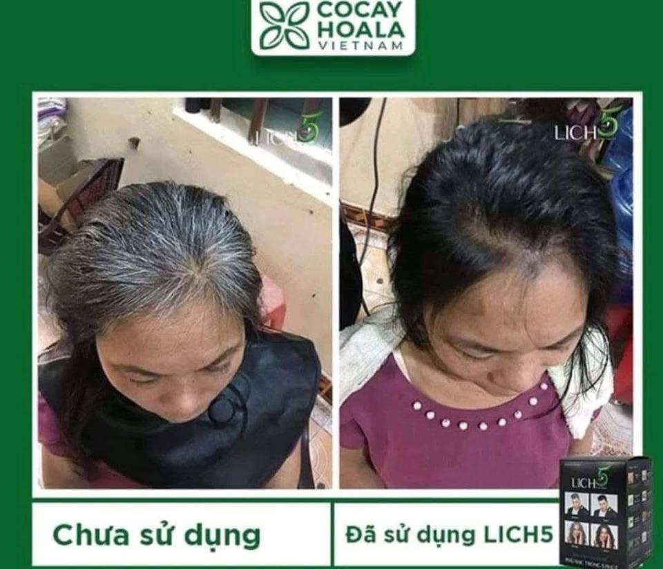 Dầu phủ bạc Lich5 HK-duoc-ban-tai-Yến nhà Loan - Yến sào Sea Nest Khánh Hoà