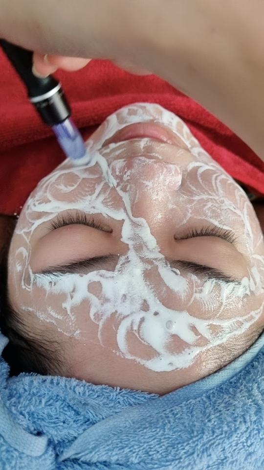 Liệu trình cấy trắng -duoc-ban-tai-Như Hội Cosmetics