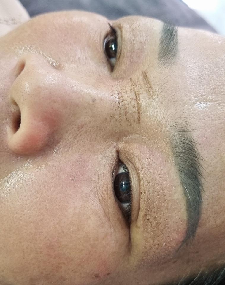 Xóa nhăn+rảnh cười -duoc-ban-tai-Như Hội Cosmetics