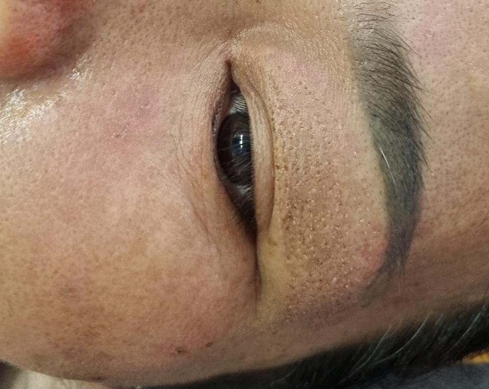 Nhấn mí -duoc-ban-tai-Như Hội Cosmetics