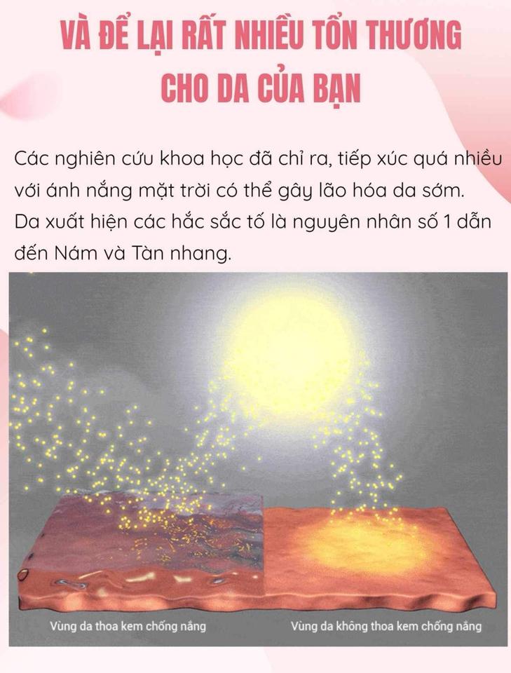 Sữa chống nắng SPECIAL - Mini-duoc-ban-tai-Siêu thị Special