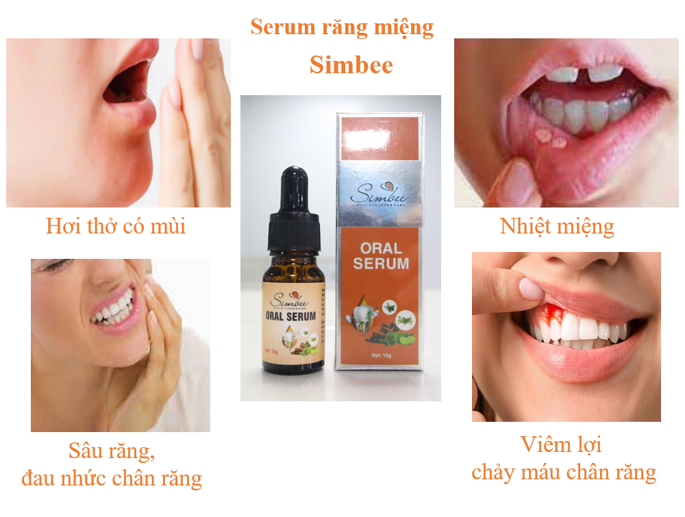 SERUM RĂNG MIỆNG - Thơm miệng, sạch miệng, kháng khuẩn, chống viêm-duoc-ban-tai-Lê Trang Nhung