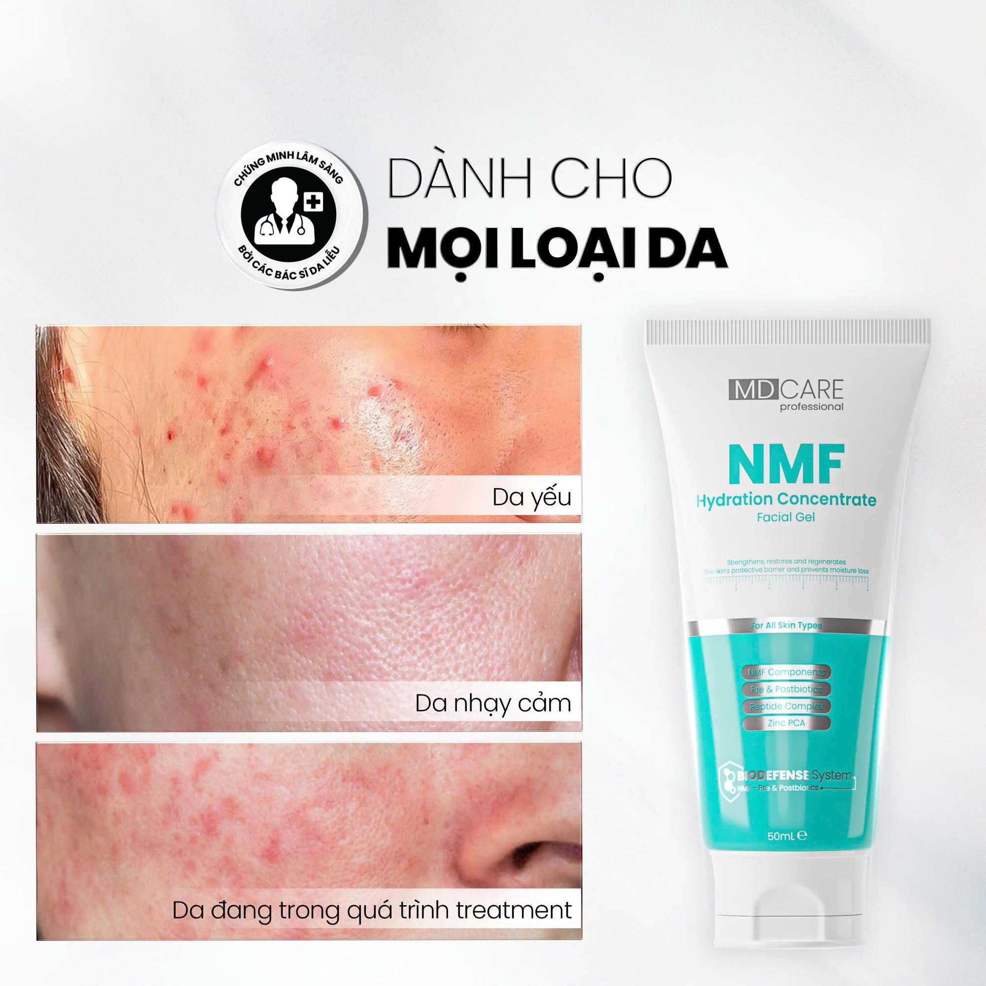 Gel Kiểm Soát Dầu Phục Hồi Da MD Care NMF Hydration Concentrate Facial 50ml-duoc-ban-tai-Tiệm Nhà Mịn