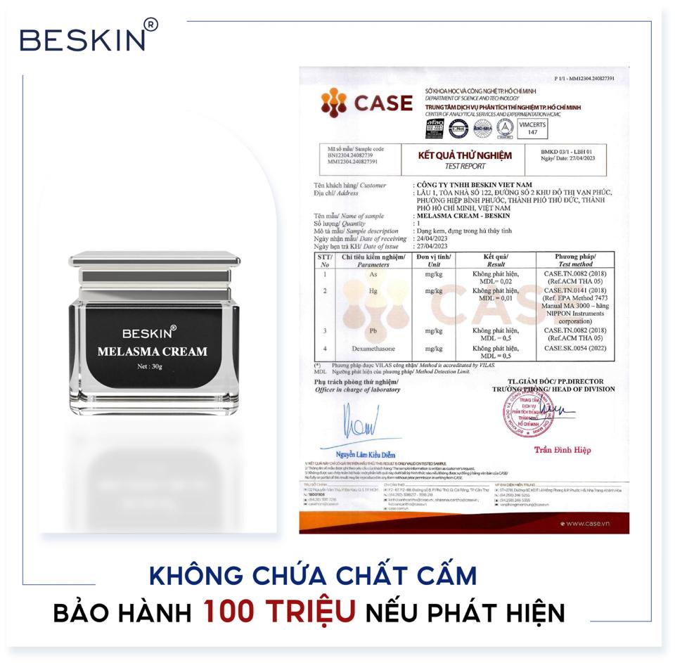 [ BESKIN ] - Kem Face Nám Tàn Nhang Size Mini-duoc-ban-tai-Ny Beauty Hair