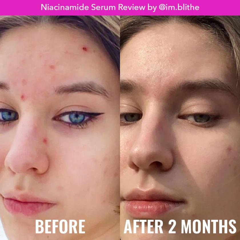 Serum cân bằng da Good Molecules | Niacinamide Serum-duoc-ban-tai-Offload Spa