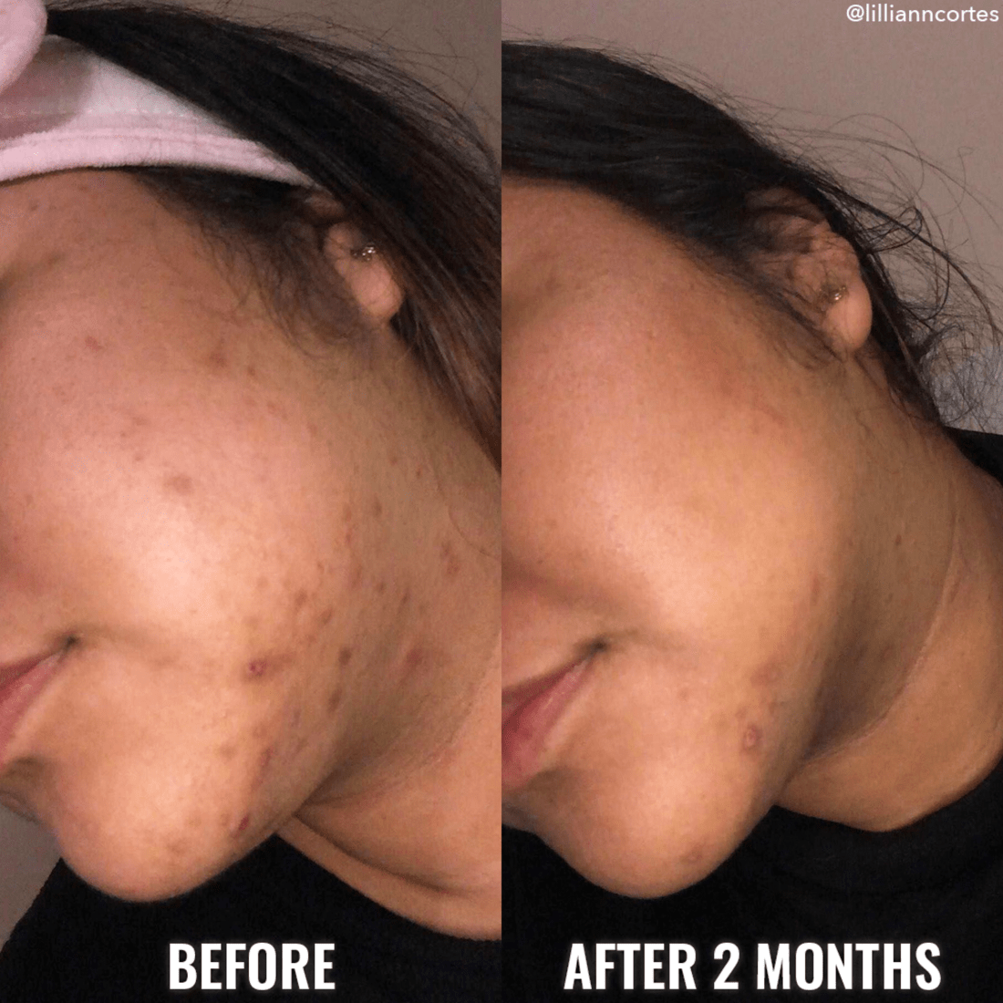 Serum cân bằng tông màu da Good Molecules | Discoloration Correcting Serum cải thiện làn da bị tăng sắc tố-duoc-ban-tai-Offload Spa