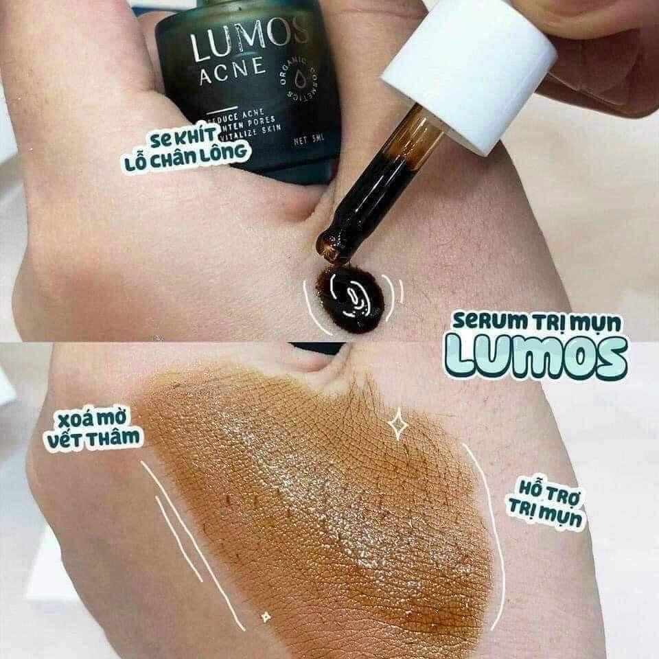 Serum mụn Lumos-duoc-ban-tai-Mỹ phẩm Linh Meo