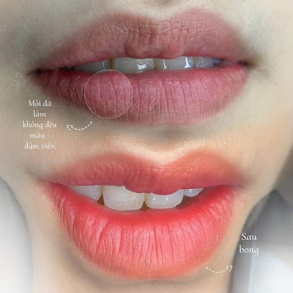 Khử Nền Môi Thâm-duoc-ban-tai-𝐐𝐁 𝐁𝐄𝐀𝐔𝐓𝐘 & 𝐀𝐂𝐀𝐃𝐄𝐌𝐘