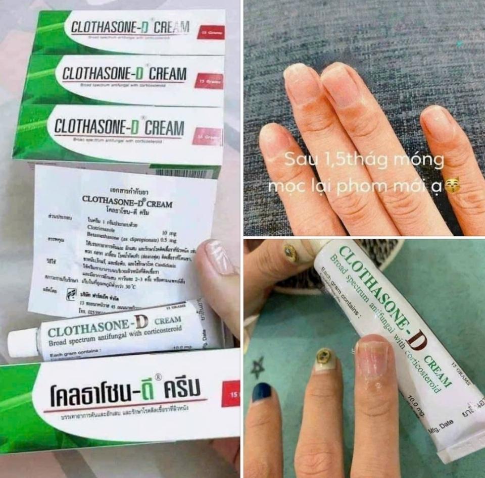 Thuốc Trị Nấm Móng Thái lan-duoc-ban-tai-Nguyễn Ngọc Lan