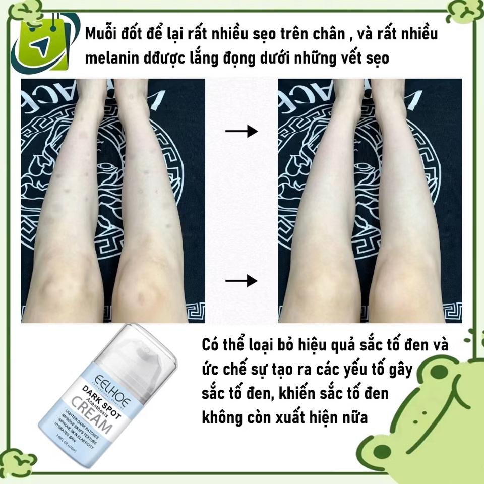 Kem làm trắng da Kem Thâm Nách kem làm trắng vùng kín bikini 50g Nuôi dưỡng và tái tạo da trắng sáng-duoc-ban-tai-Shop Hà Linh