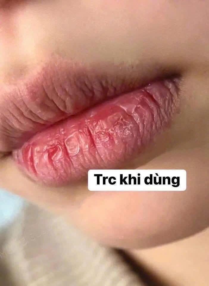 Dưỡng + Ủ môi oganic JOJOBA-duoc-ban-tai-K-DAN HOUSE