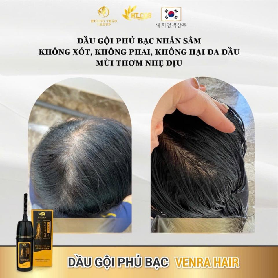 𝐃𝐚̂̀𝐮 𝐆𝐨̣̂𝐢 𝐏𝐡𝐮̉ 𝐁𝐚̣𝐜 𝐕𝐄𝐍𝐑𝐀 𝐇𝐀𝐈𝐑 – Đ𝐞𝐧 𝐭𝐨́𝐜 𝐜𝐡𝐢̉ 𝐬𝐚𝐮 𝟏 𝐥𝐚̂̀𝐧 𝐠𝐨̣̂𝐢 – 𝐀𝐧 𝐭𝐨𝐚̀𝐧 𝐤𝐡𝐨̂𝐧𝐠 𝐡𝐚̣𝐢 𝐭𝐨́𝐜-duoc-ban-tai-Hoa Nguyễn Natural Skin