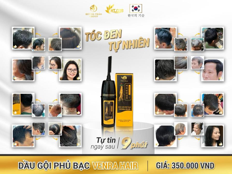 𝐃𝐚̂̀𝐮 𝐆𝐨̣̂𝐢 𝐏𝐡𝐮̉ 𝐁𝐚̣𝐜 𝐕𝐄𝐍𝐑𝐀 𝐇𝐀𝐈𝐑 – Đ𝐞𝐧 𝐭𝐨́𝐜 𝐜𝐡𝐢̉ 𝐬𝐚𝐮 𝟏 𝐥𝐚̂̀𝐧 𝐠𝐨̣̂𝐢 – 𝐀𝐧 𝐭𝐨𝐚̀𝐧 𝐤𝐡𝐨̂𝐧𝐠 𝐡𝐚̣𝐢 𝐭𝐨́𝐜-duoc-ban-tai-Hoa Nguyễn Natural Skin