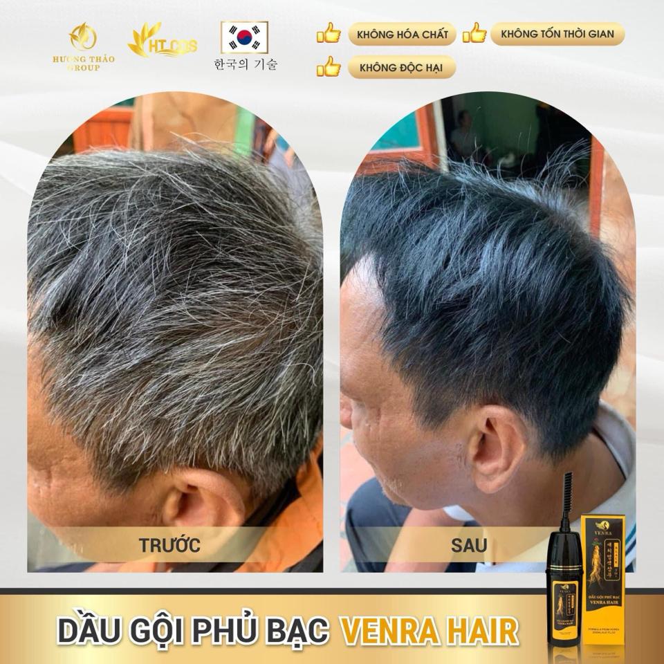 𝐃𝐚̂̀𝐮 𝐆𝐨̣̂𝐢 𝐏𝐡𝐮̉ 𝐁𝐚̣𝐜 𝐕𝐄𝐍𝐑𝐀 𝐇𝐀𝐈𝐑 – Đ𝐞𝐧 𝐭𝐨́𝐜 𝐜𝐡𝐢̉ 𝐬𝐚𝐮 𝟏 𝐥𝐚̂̀𝐧 𝐠𝐨̣̂𝐢 – 𝐀𝐧 𝐭𝐨𝐚̀𝐧 𝐤𝐡𝐨̂𝐧𝐠 𝐡𝐚̣𝐢 𝐭𝐨́𝐜-duoc-ban-tai-Hoa Nguyễn Natural Skin