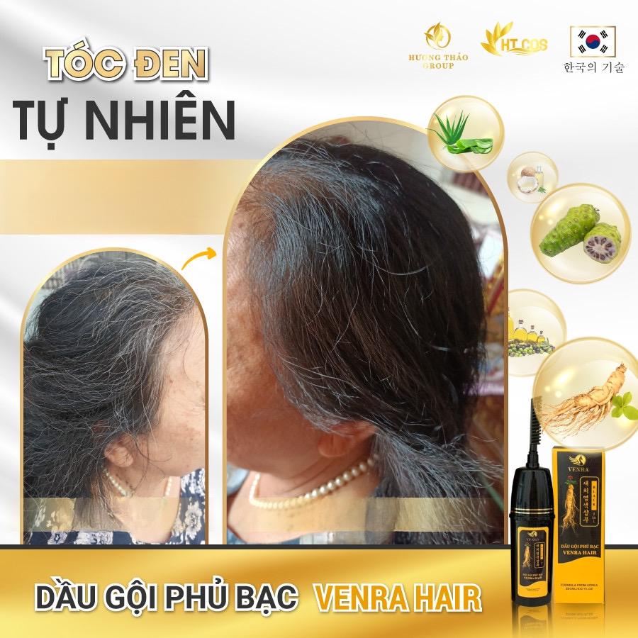 𝐃𝐚̂̀𝐮 𝐆𝐨̣̂𝐢 𝐏𝐡𝐮̉ 𝐁𝐚̣𝐜 𝐕𝐄𝐍𝐑𝐀 𝐇𝐀𝐈𝐑 – Đ𝐞𝐧 𝐭𝐨́𝐜 𝐜𝐡𝐢̉ 𝐬𝐚𝐮 𝟏 𝐥𝐚̂̀𝐧 𝐠𝐨̣̂𝐢 – 𝐀𝐧 𝐭𝐨𝐚̀𝐧 𝐤𝐡𝐨̂𝐧𝐠 𝐡𝐚̣𝐢 𝐭𝐨́𝐜-duoc-ban-tai-Hoa Nguyễn Natural Skin