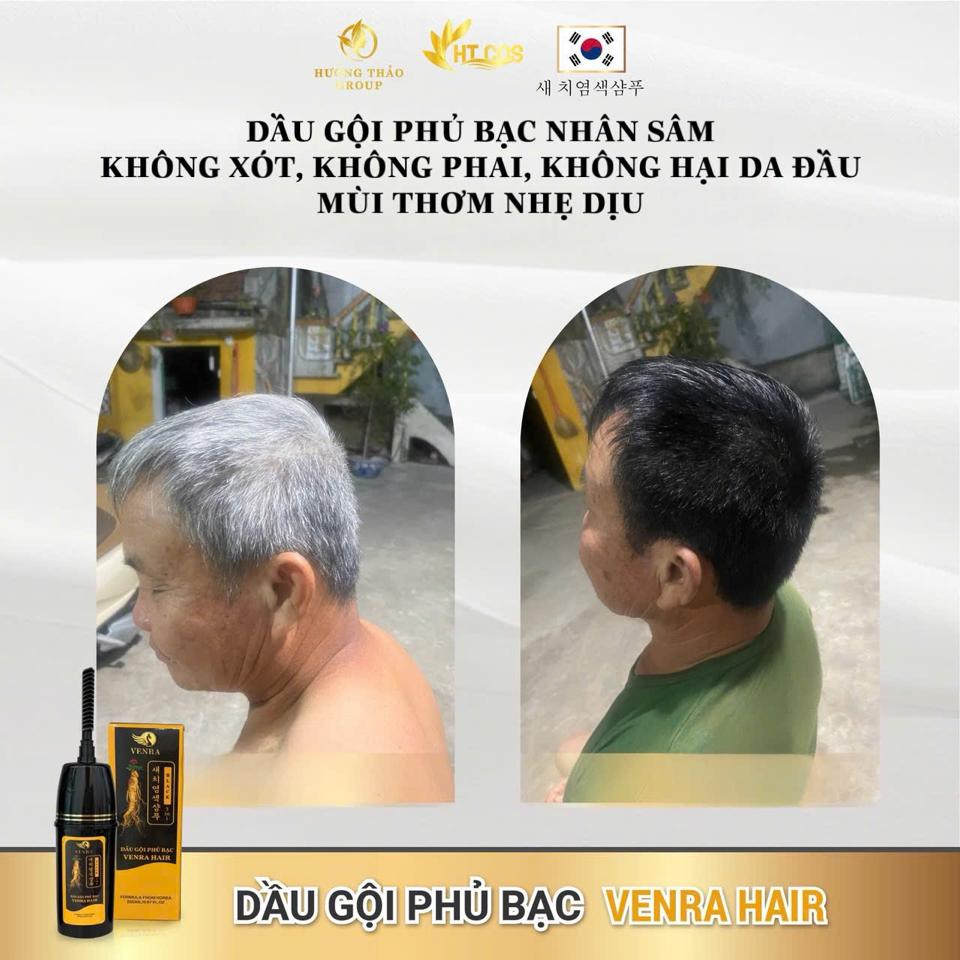 𝐃𝐚̂̀𝐮 𝐆𝐨̣̂𝐢 𝐏𝐡𝐮̉ 𝐁𝐚̣𝐜 𝐕𝐄𝐍𝐑𝐀 𝐇𝐀𝐈𝐑 – Đ𝐞𝐧 𝐭𝐨́𝐜 𝐜𝐡𝐢̉ 𝐬𝐚𝐮 𝟏 𝐥𝐚̂̀𝐧 𝐠𝐨̣̂𝐢 – 𝐀𝐧 𝐭𝐨𝐚̀𝐧 𝐤𝐡𝐨̂𝐧𝐠 𝐡𝐚̣𝐢 𝐭𝐨́𝐜-duoc-ban-tai-Hoa Nguyễn Natural Skin