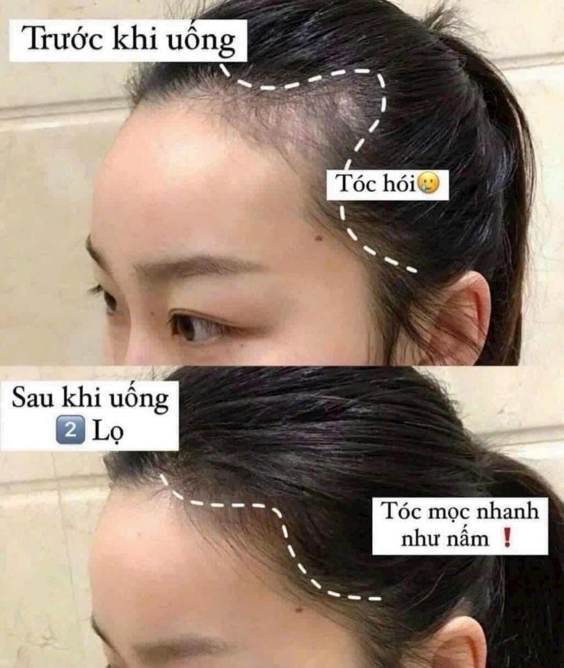 Viên uống mọc tóc Natrol Biotin 10,000 mcg-duoc-ban-tai-0352842688