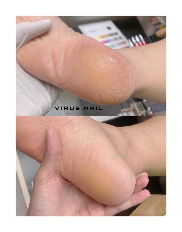 Chà gót chân -duoc-ban-tai-Virusn95nailroom