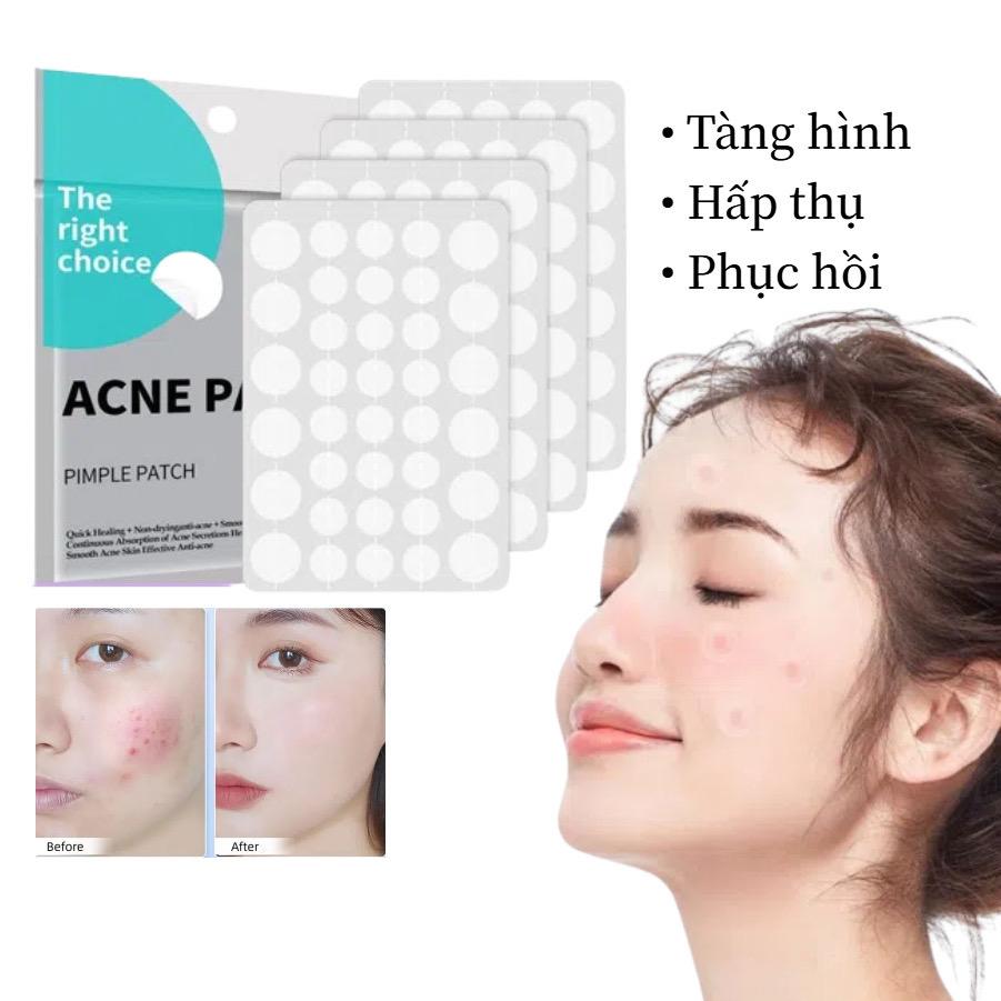 Dán mụn -duoc-ban-tai-Hanana Bình Lục