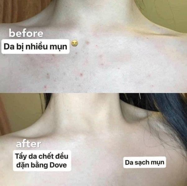 Tẩy da chết dove 225ml-duoc-ban-tai-Nhà mít