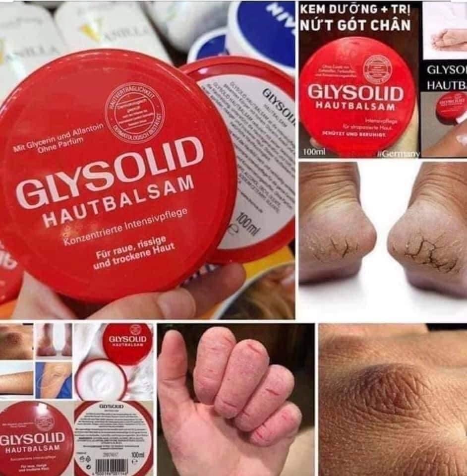 Kem nẻ đỏ Glysolid Đức-duoc-ban-tai-Nhà mít