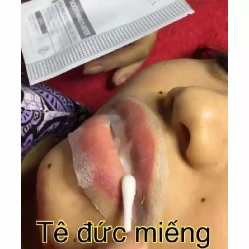 TÊ MIẾNG BECABELA ( tê đức)-duoc-ban-tai-NHƯ NHƯ SHOP