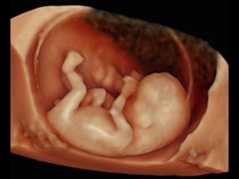 Siêu âm HÌNH THÁI quý 3 5D - khám tư vấn-duoc-ban-tai-Phòng Khám Sản Phụ Khoa Bs Trần Phước Gia