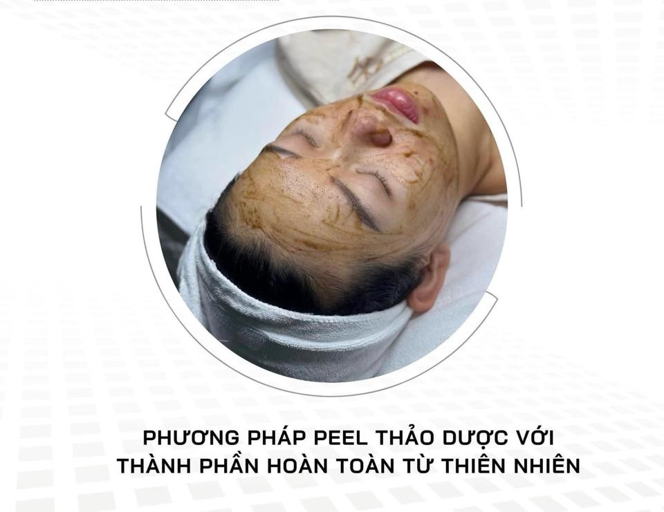 Meso Peel plus’s-duoc-ban-tai-Bờ Tờ Tờ