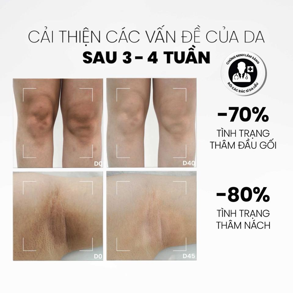 Duỡng thể B.R.I.G.H.T  sáng da body-duoc-ban-tai-Bờ Tờ Tờ