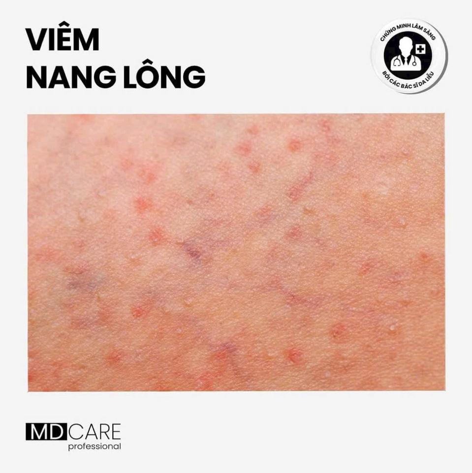Sữa tắm C.L.E.A.N.S.E dành cho các vần đề Da-duoc-ban-tai-Bờ Tờ Tờ