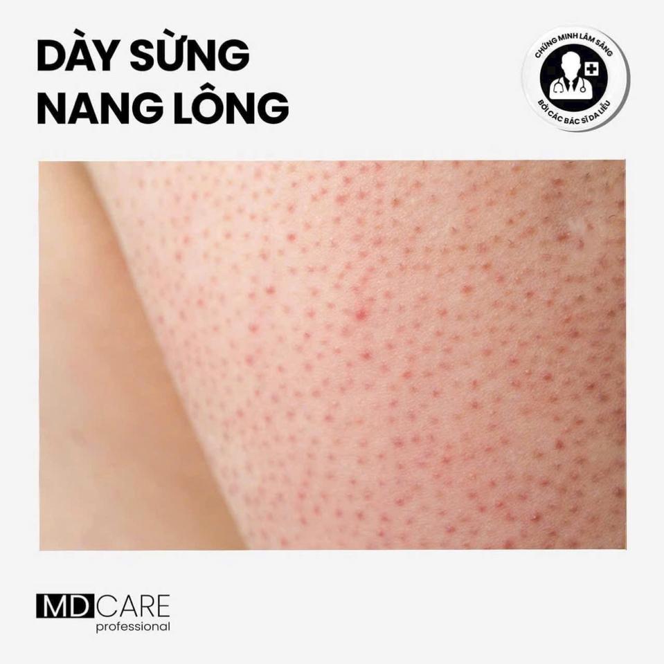 Sữa tắm C.L.E.A.N.S.E dành cho các vần đề Da-duoc-ban-tai-Bờ Tờ Tờ