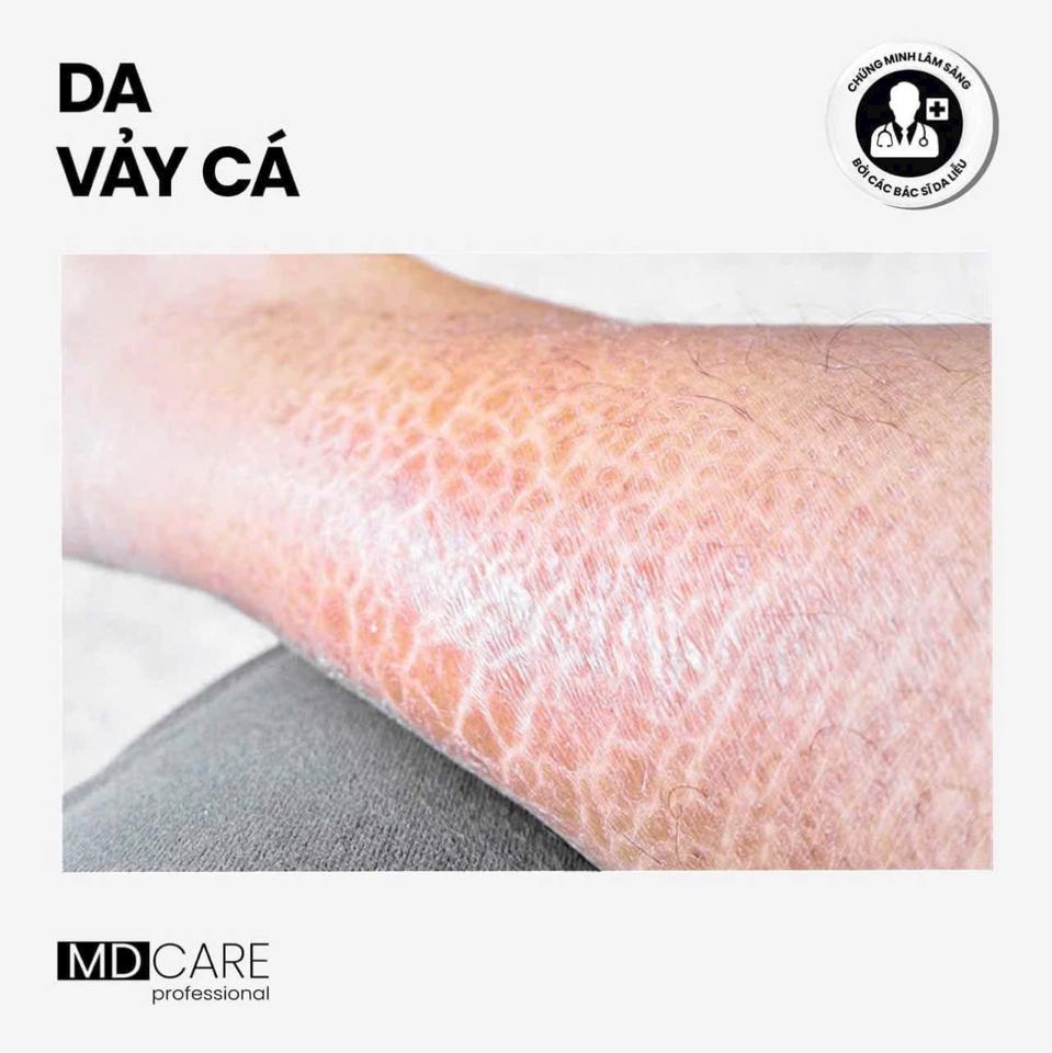 Sữa tắm C.L.E.A.N.S.E dành cho các vần đề Da-duoc-ban-tai-Bờ Tờ Tờ