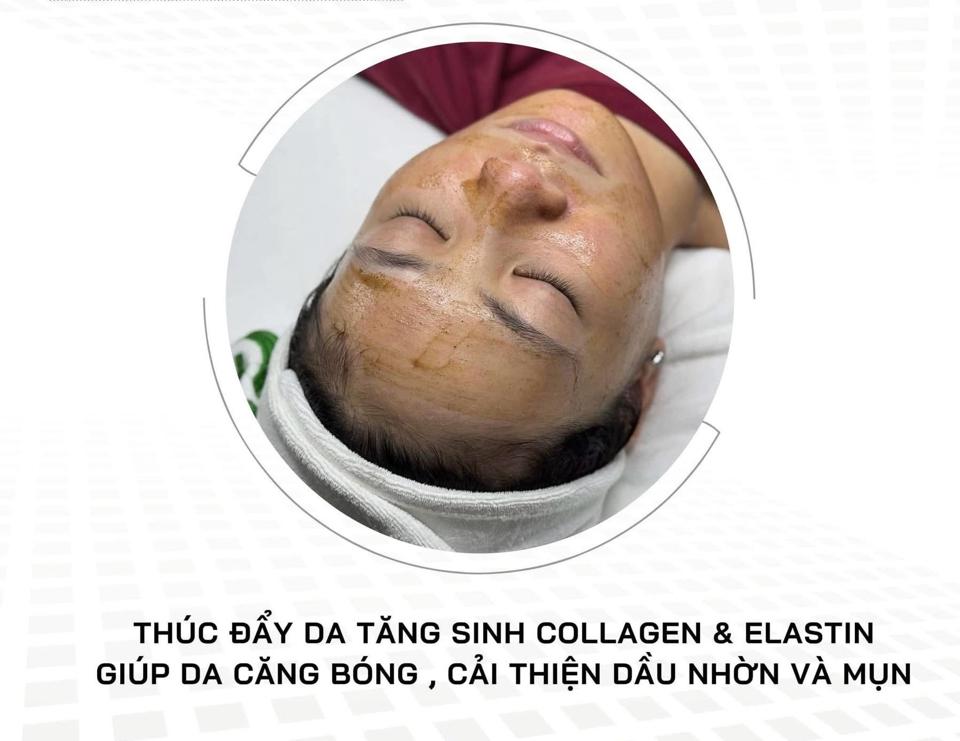Meso Peel plus’s-duoc-ban-tai-Bờ Tờ Tờ