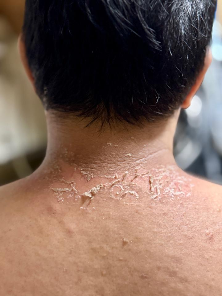 Peeling_ Khử thâm body-duoc-ban-tai-Bờ Tờ Tờ