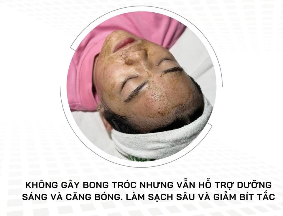 Meso Peel plus’s-duoc-ban-tai-Bờ Tờ Tờ