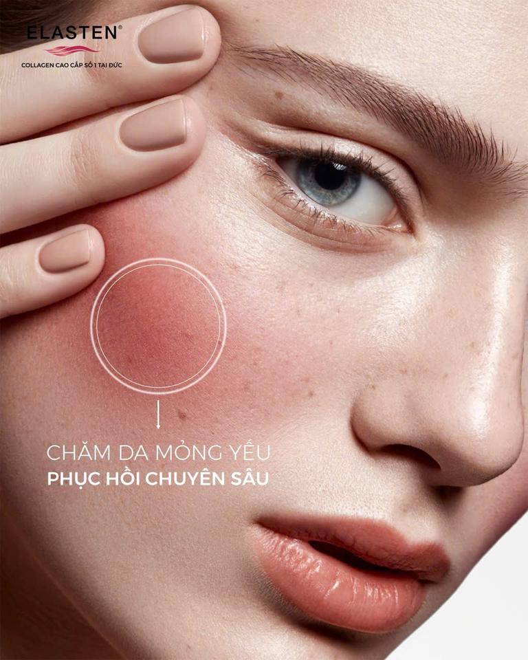 Collagen ELASTEN chính hảng -duoc-ban-tai-Bờ Tờ Tờ