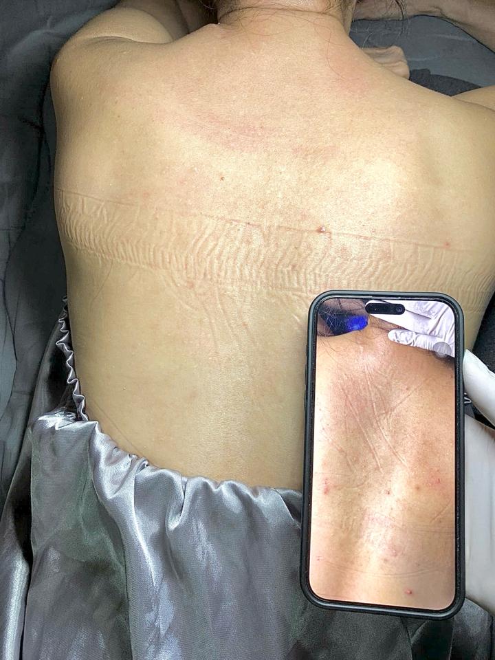 Peeling_khử thâm body-duoc-ban-tai-Bờ Tờ Tờ