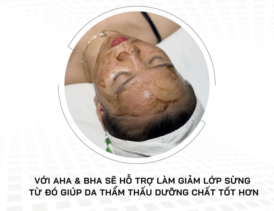 Meso Peel plus’s-duoc-ban-tai-Bờ Tờ Tờ