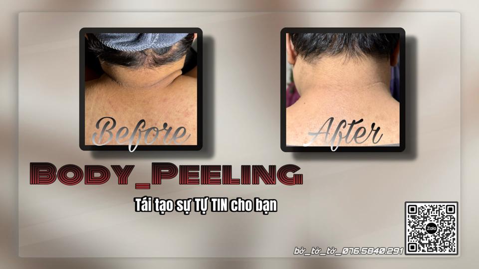 Peeling_ Khử thâm body-duoc-ban-tai-Bờ Tờ Tờ